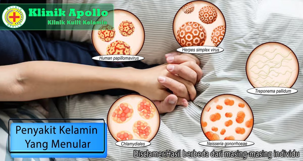 Penyakit Yang Dapat Menular Melalui Kontak Langsung