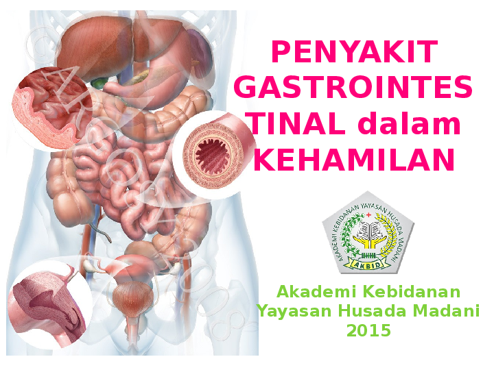 Penjelasan Lengkap Mengenai Penyakit Gastrointestinal Yang Umum