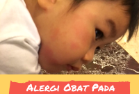 Obat Untuk Mengatasi Alergi Makanan Pada Anak